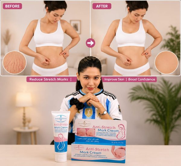 Stretch Mark নিয়ে আর চিন্তা নয় | Anti Stretch Mark Cream